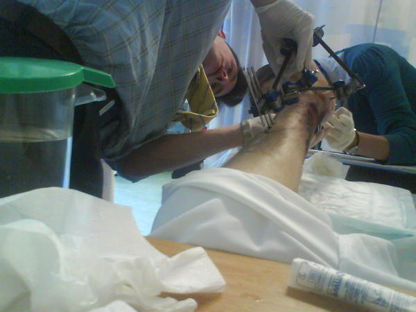 my_leg_injuries__1__by_lightningtremlett.jpg
